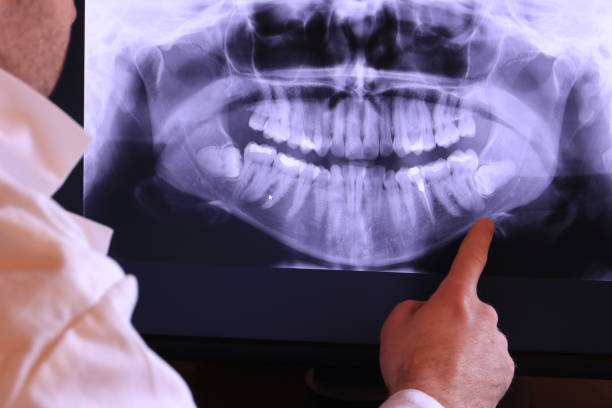 Best Emergency Dental Care for Broken or Chipped Teeth in Mabank, TX