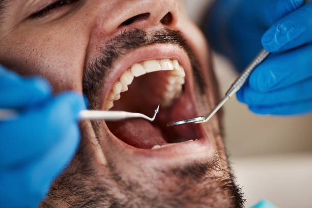 Best Emergency Gum Treatment in Mabank, TX